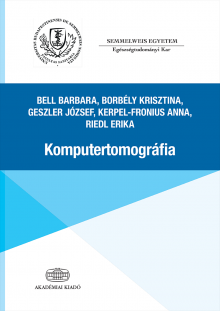 Komputertomográfia