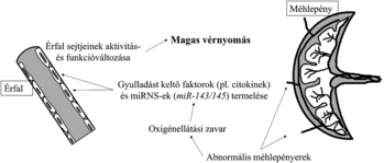 Diagram a magas vérnyomás hatásairól az érfal és méhlepény működésére, gyulladást keltő faktorok termelése és oxigénellátási zavarok.