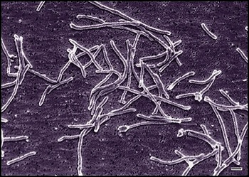 Elektronmikroszkópos felvétel Streptomyces baktériumok szálas szerkezetéről.