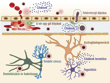A vér-agy gát károsodása vérzést, fehérvérsejt ájutást, citokinek termelést, demielinizációt, oxidatív stresszt, asztroglia degenerációt és fagocitózist okoz.